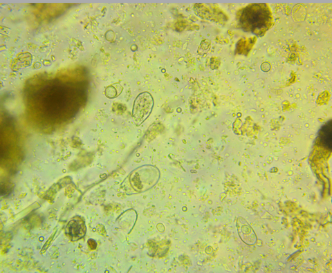 Sample of compost under microscope. There is a significant abundance of microorganisms (bacteria, fungi, protozoa, nematodes) evident